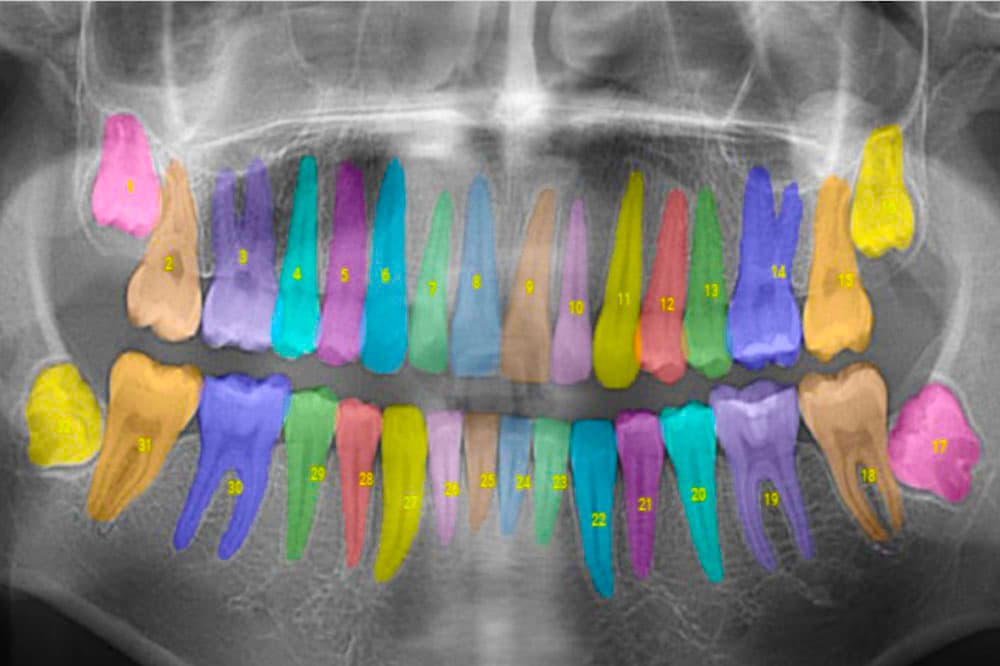 Leading the Way in AI Dentistry: Our Transformative Experience with the Apteryx AI Diagnosing Tool, Practice News article from Shenandoah Dental Center
