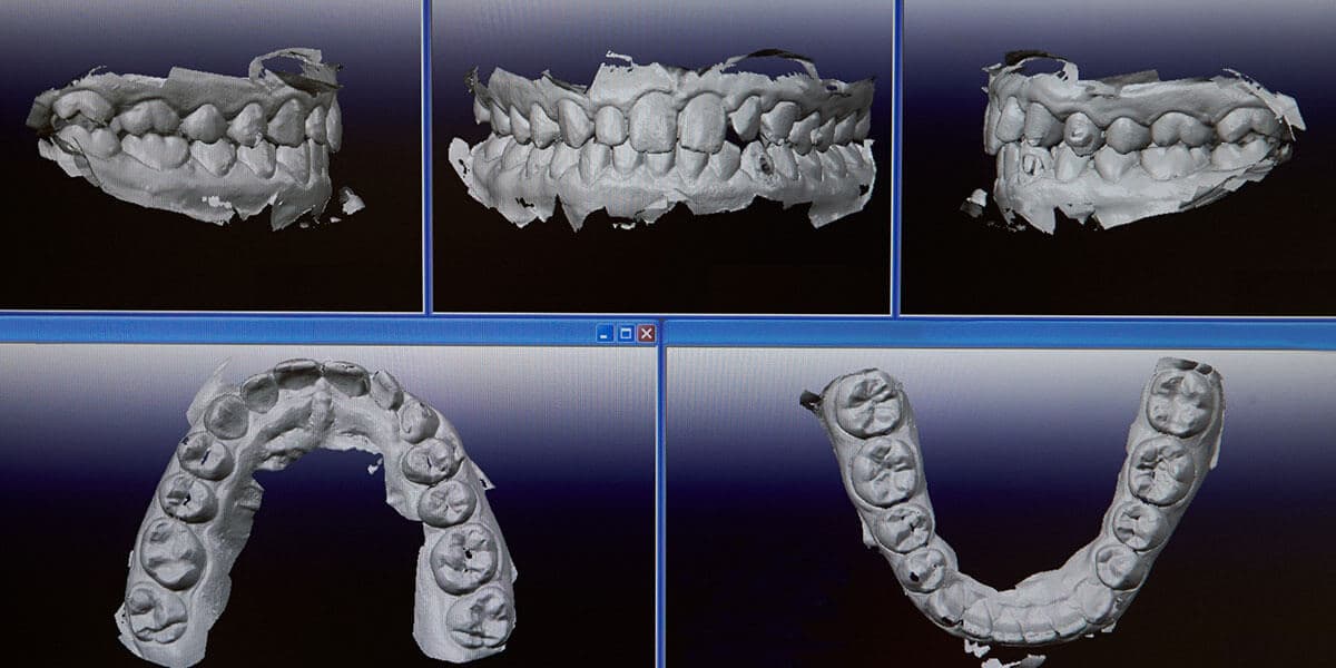 Revolutionizing Oral Health: Understanding the Role of Advanced Dental Technologies, Patient Experience article from Shenandoah Dental Center